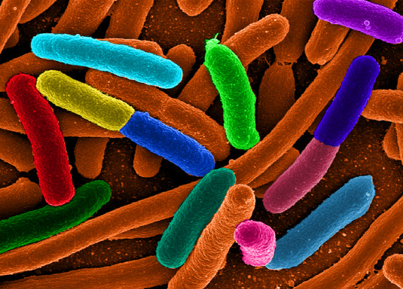 E coli