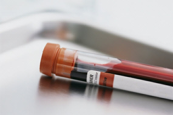 psa screening