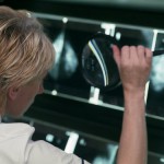 Screening for Lung Cancer