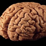 Osmolality and Brain Injury